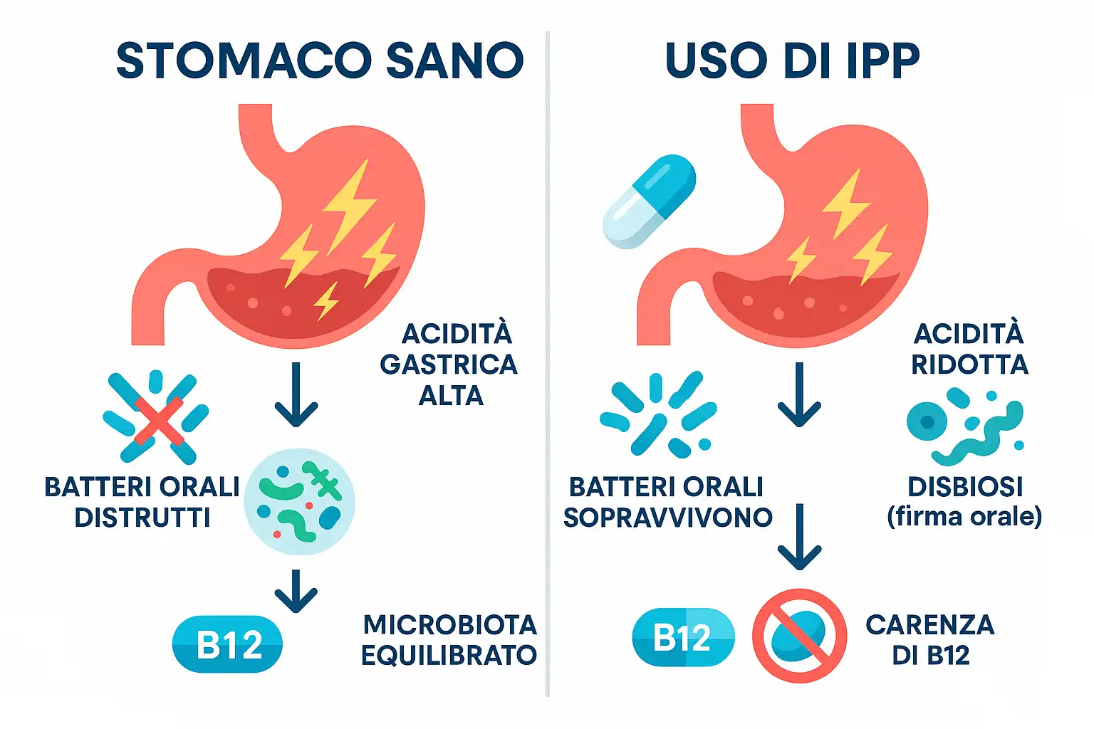 Confronto tra stomaco sano e sotto l'effetto di IPP, mostrando gli impatti su batteri e assorbimento della vitamina B12.